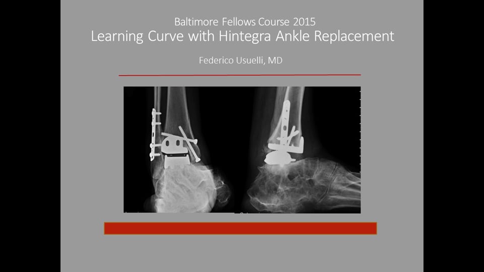 Baltimore Fellows Course 2015: Learning Curve with Hintegra Ankle Replacement