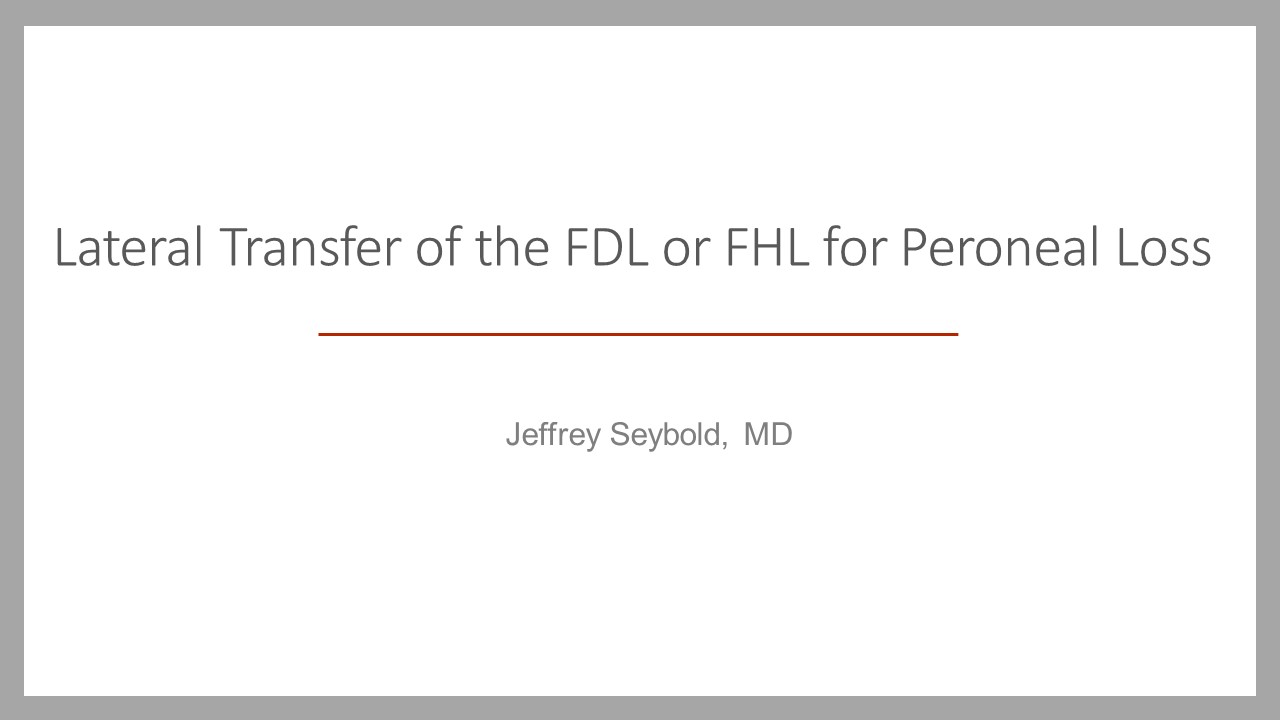 Baltimore Fellows Course 2013: Lateral Transfer of the FDL or FHL for Peroneal Loss-JD Seybold,MD