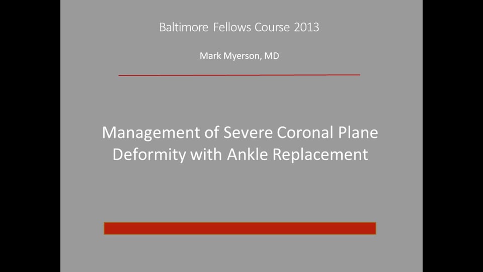 Baltimore Fellows Course 2013: Management of Severe Coronal Plane Deformity with Ankle Replacement