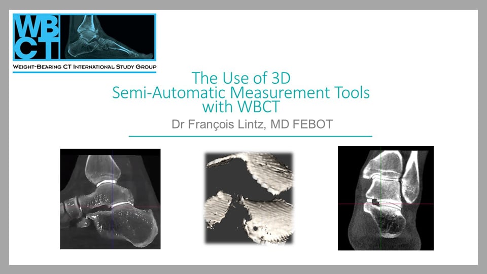 Int WBCT Society Webcast: The use of 3D semi-automatic measurement tools with WBCT