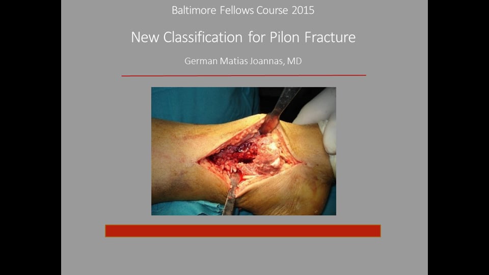Baltimore Fellows Course 2015: New Classification for Pilon Fracture