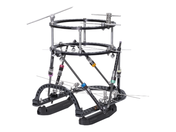 Arthrex Ring Fixation System